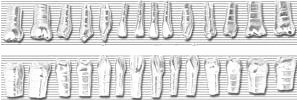 Dentes p/Typodont, jogo dentes: a-concavos c/28 b-lisos c/ranhura na raiz (metal) c/28 c-de acrilico