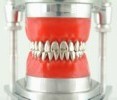 Montagem c/2 unidades.: classe 2 c/esc.crescimento mandibular. classe 1 normal superior e inferior.